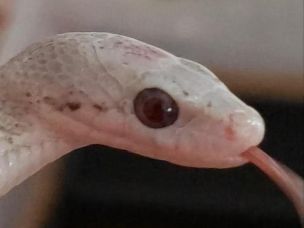 EYE