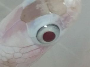 EYE