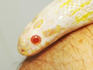 EYE
