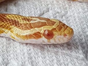 EYE