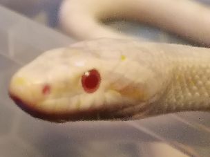 EYE