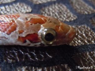EYE