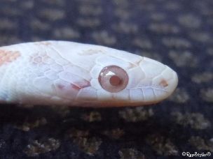EYE