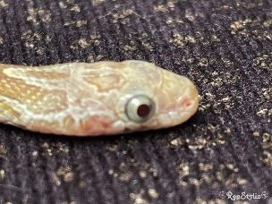 EYE