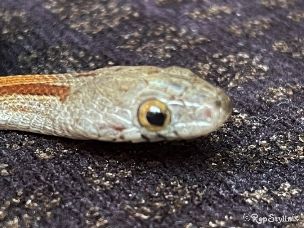 EYE
