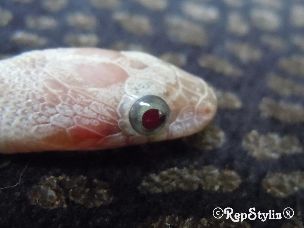 EYE