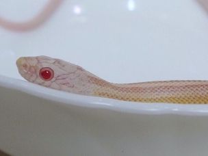 EYE